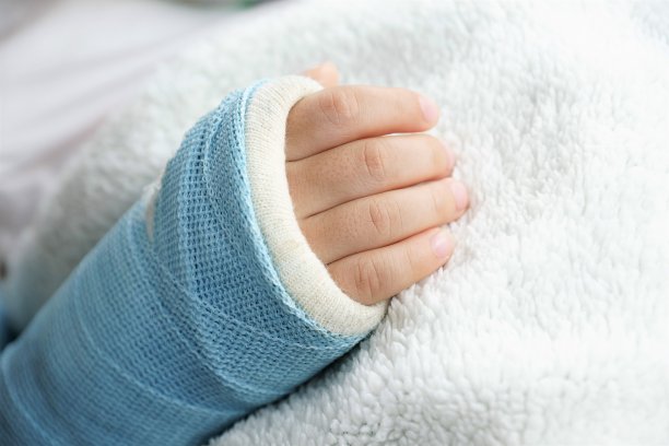 cast