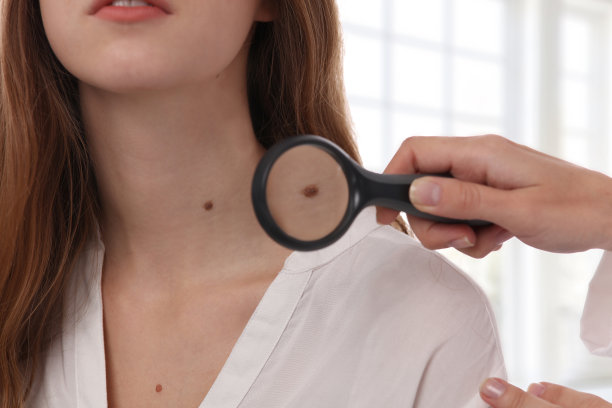 mole