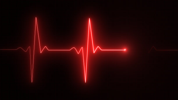 ekg