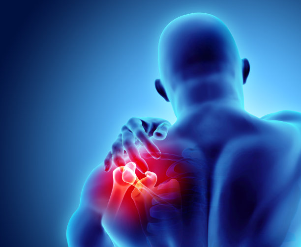 arthritis