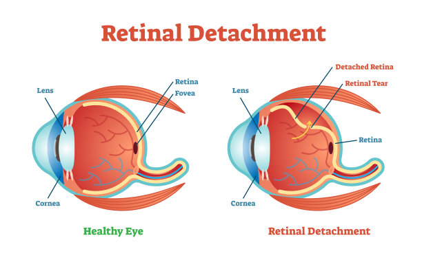 retina