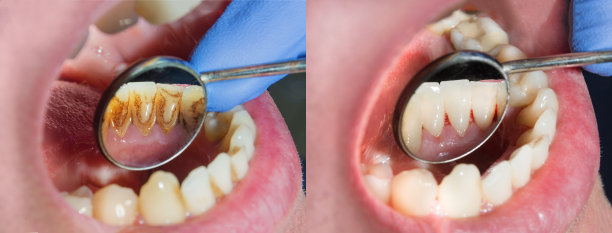 dental