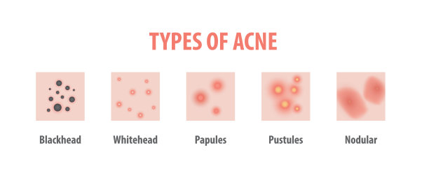 pores