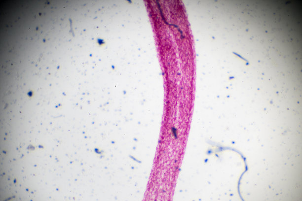 cnidaria