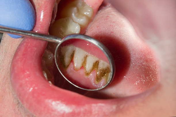teeth