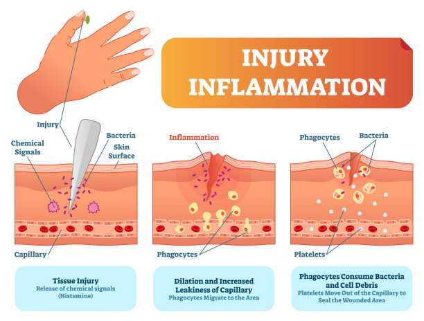 inflammation