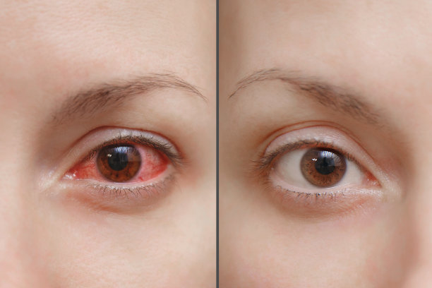 eyes