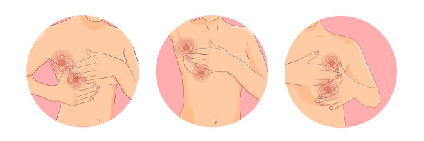 breast