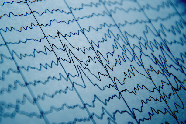 eeg