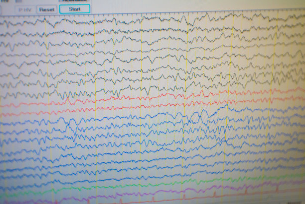 eeg