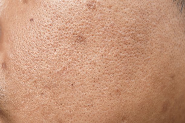 skin