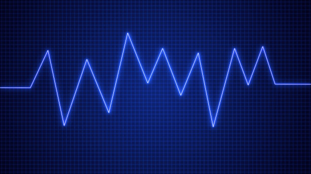 ekg