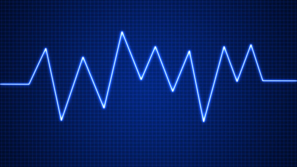 ekg