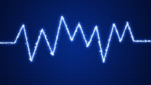 ekg