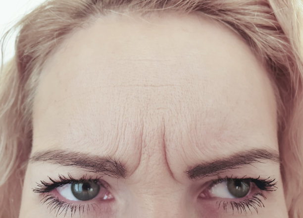 wrinkles