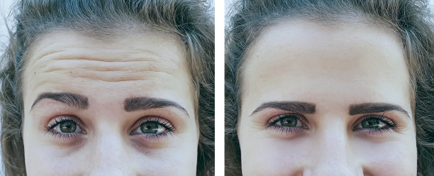 brows