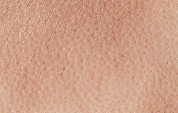 pores