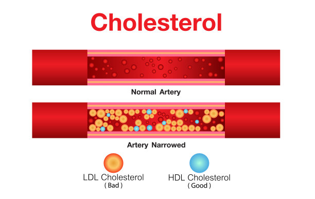 cholesterol