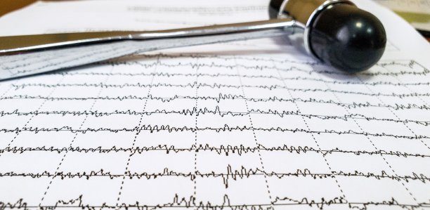 eeg