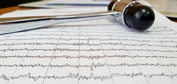 eeg