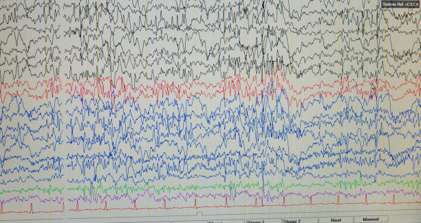 eeg