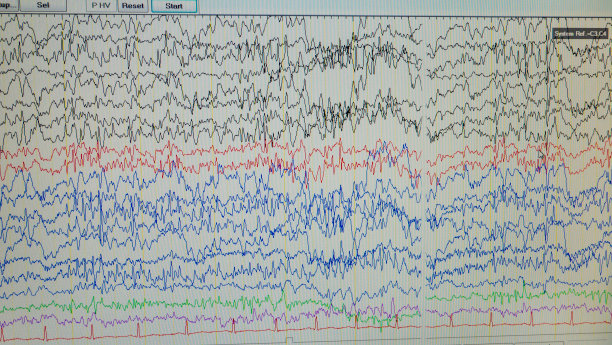 eeg
