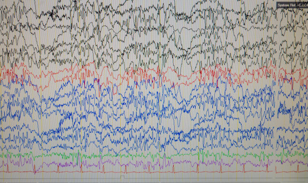 eeg