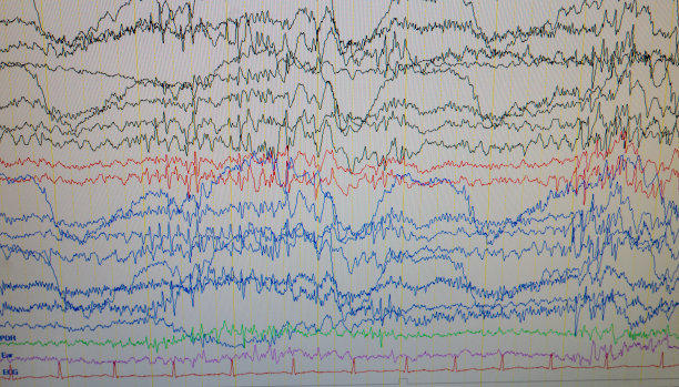 eeg