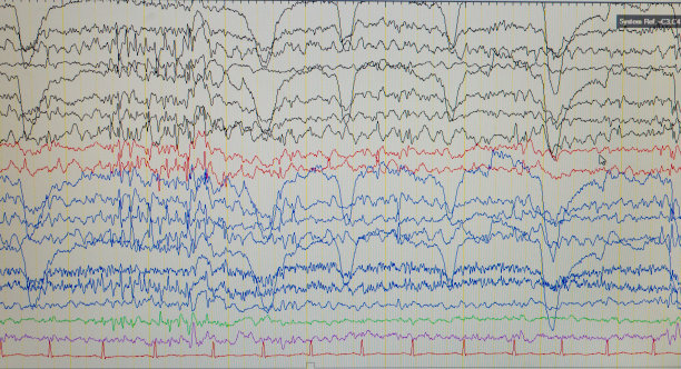 eeg