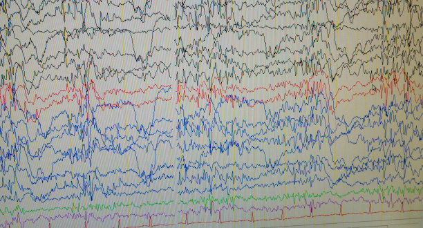 eeg