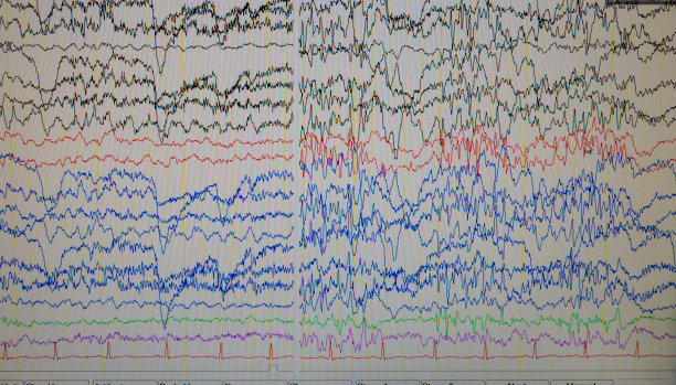 eeg