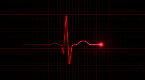 ekg
