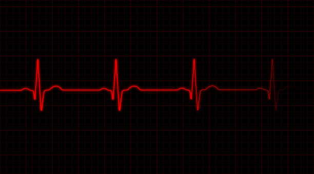 ecg