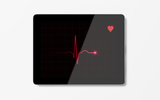 ecg