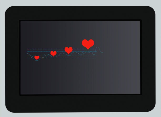 ekg