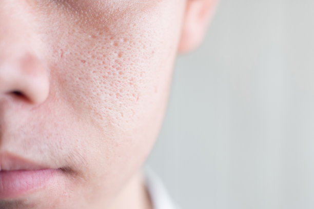 pores