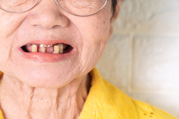 pensioner