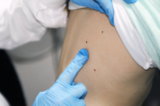 mole