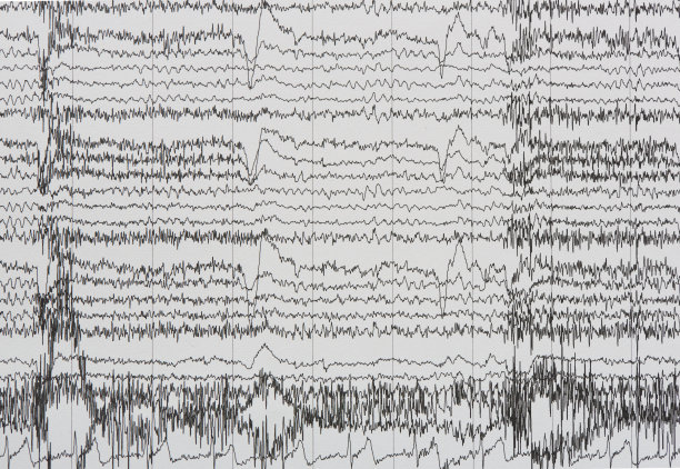 eeg