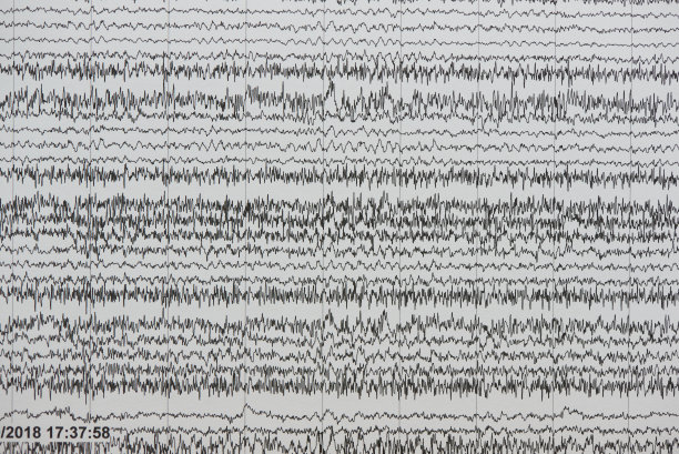 eeg