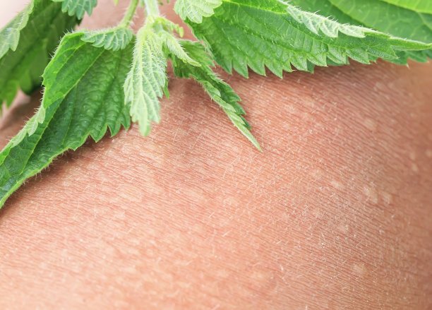 nettles