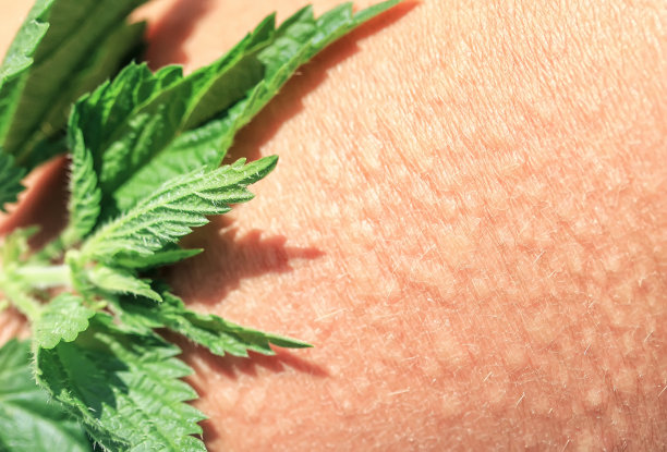 nettles