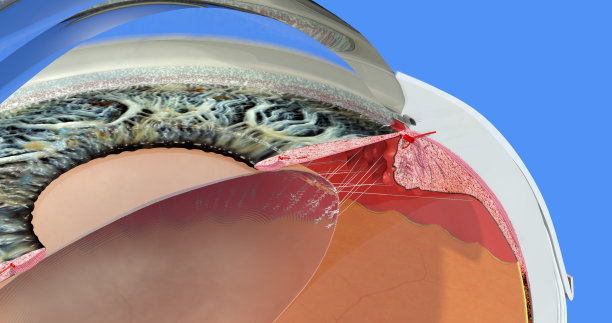 retina