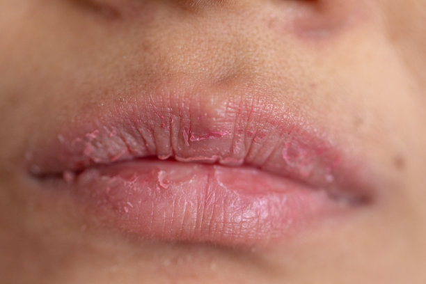 lip