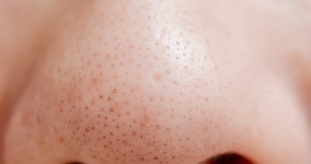 pores
