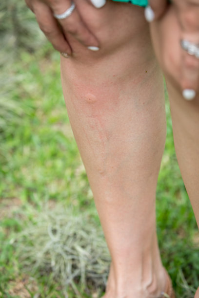mosquito