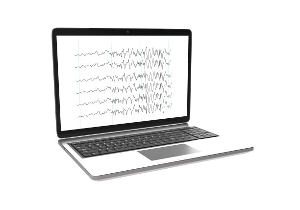 eeg