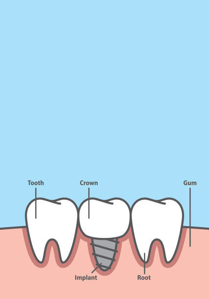 牙科口腔材料