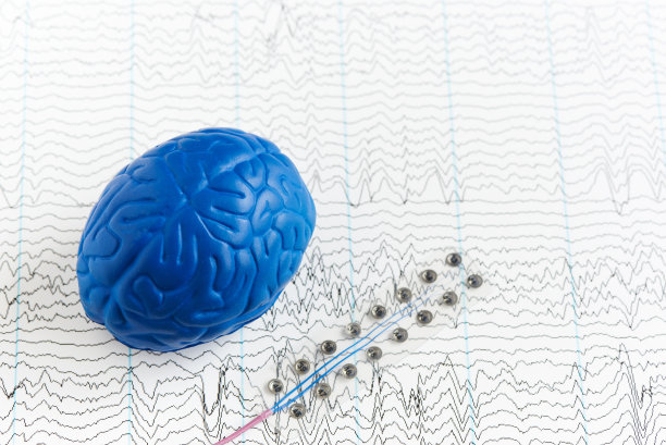 eeg