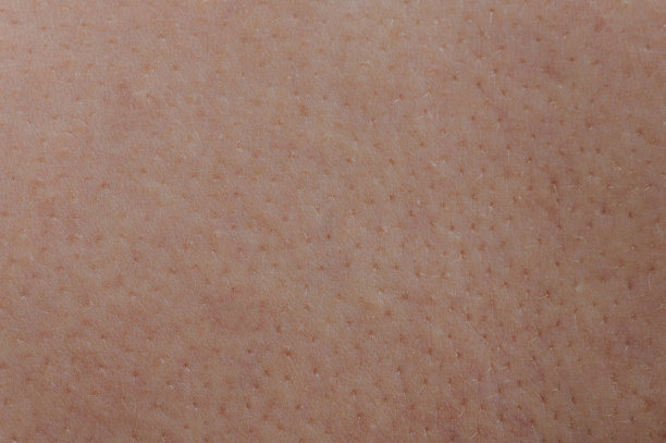 pores